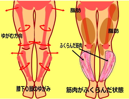 膝下が曲がって見える 膝下が太い人の特徴 中目黒整体レメディオ 美脚 X脚 O脚矯正 小尻 産後の骨盤矯正によるボディラインの改善